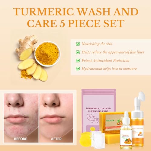 Roseye Turmeric Facial Kit with Brush - Foaming Face Wash & Soap for Refreshed Feel, Hydration, Subtle Shimmer - Unisex Skincare-5pcs