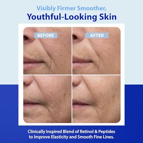 Dr. Denese HydroShield Dream Cream 3.4 oz ? Advanced Moisturizer with Retinol, Peptides and Ceramides for Smooth Radiant Skin, Improved Elasticity and Deep Hydration ? Doctor Developed, Cruelty Free