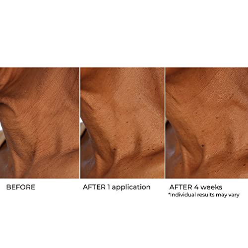 NassifMD Age Defying Neck & D?collet? Serum, Lifts and Firms Thin Neck Skin, Hydrates and Smooths