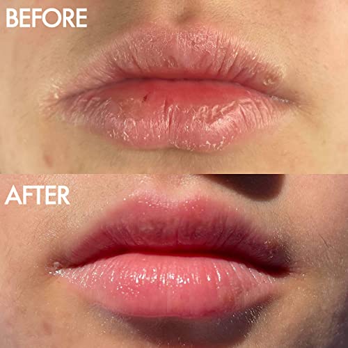 Lanolips Coconut & Overnight Lip Balm Set ? 12 Hour Overnight Lip Mask (0.52 oz) + 101 Ointment Coconutter (0.35 oz) ? Hydrating Lanolin Balms for Dry Lips & Skin