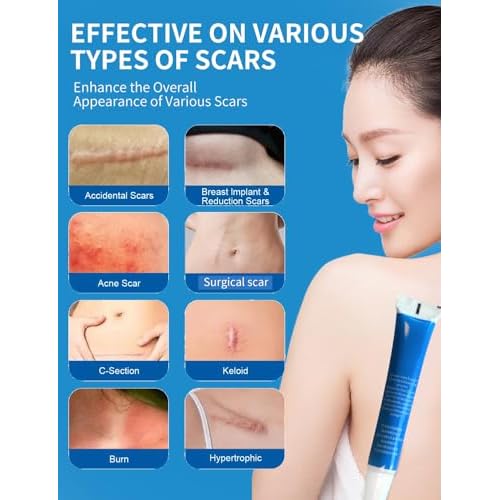 Silicone Scar Gel, Advanced Scar Cream treating for New and Old Scars, Surgical Scars, Burn Scars, Stretch Marks, Acne Scars, Dark markings, Keloid Removal 0.70 oz (2tube)
