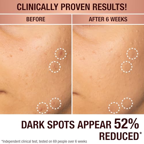 SHANI DARDEN SKIN CARE Lactic Acid Face Serum Travel Size, Active Night Serum to Help with the Look of Radiant and Smooth Skin, Gentle But Powerful Face Exfoliator, 0.34 fl oz