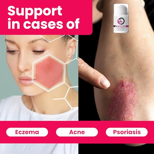 EUSPHERA - 4DERMA - Soothing Cream for Eczema with Hemp Extract - Natural Itch Relief Cream for Psoriasis, Eczema, Dry Skin, Dermatitis 1.7 Oz