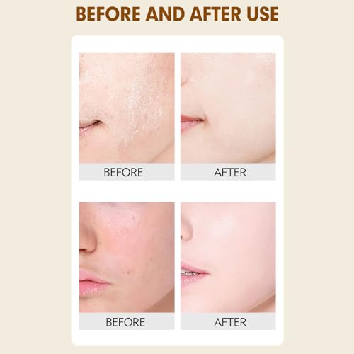 Rice Exfoliating Ampoule Set, White Black Rice Exfoliant Serum, Body and Face Exfoliator, Peeling Ampoule & Dead Skin Remover - Gentle Peel and Pore Minimizing & Deep Hydration