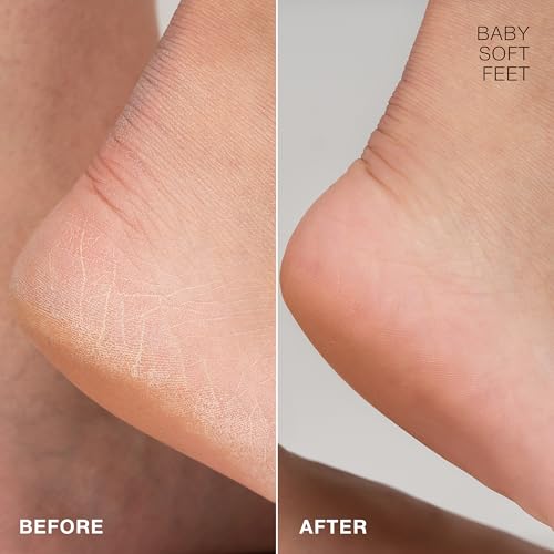 STARSKIN Magic Hour, Exfoliating Foot Mask Sock with Lactic and Glycolic Acid, Gently Removes Calluses and Dead Skin for Effective Peeling, K Beauty Skincare (4 Pack)
