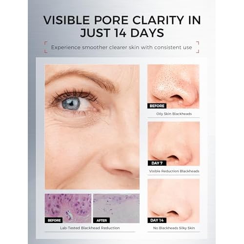 Tembusu Essence Clay Mask for Face & Sensitive Skin: Triple Mud Formula with Tembusu Extract, Deep Cleansing Pore, Oil Control, Texture Refining, Blackhead Removal ? 3.88 Oz