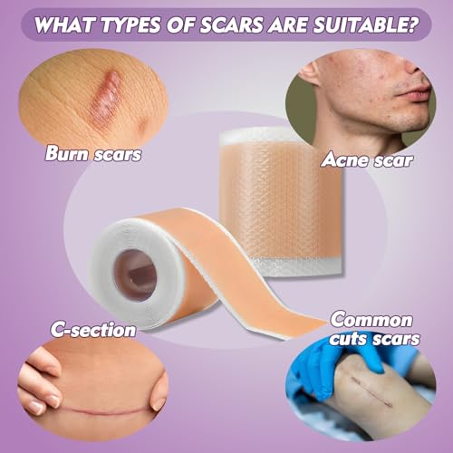 Rayyl Silicone Scar Sheets (1.6" x 60" Roll - 1.5M) - Advanced Silicone Scar Tape Roll Skin-Safe Flexible Strips for Smoother Looking Skin C-Section Recovery Everyday Scars Reusable Value Pack