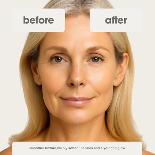 Age Reset Advanced Retinol Serum ? Professional Strength Formula with Hyaluronic Acid, Vitamin E & Botanical Extracts | Smooths Fine Lines, Firms & Brightens Skin (1 fl oz)