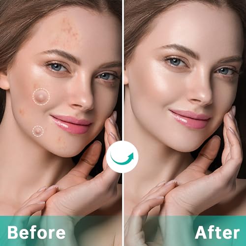 Pimple Patches for Face, Hydrocolloid Patches for Covering Zits and Blemishes, Spot Stickers with Salicylic Acid, Tea Tree Oil & Calendula Oil £¬4 Size 210 Counts Acne Patches