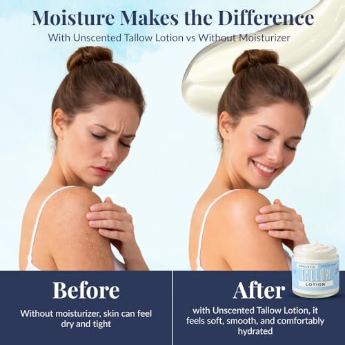 Unscented Tallow Lotion ? 9oz Pure, Preservative-Free One Ingredient Moisturizer