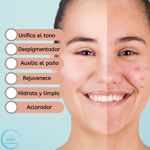 Shelo Nabel Body and Face Soap Jab?n de Leche de Burra ? Shelo Nabel | Hidratante y Regenerador | Aclara Manchas, Nutre y Suaviza | Piel Normal, Seca y Sensible | Uso Facial y Corporal | 100g