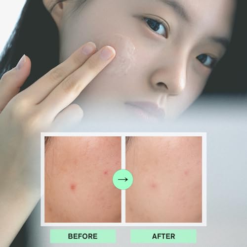 URBANAND Morning Fresh Capsule cream, Vegan Skin Care, Face Moisturizer for Skin Radiance, Lighgtweight gel for Glow Hydration, Korean Skin Care (5.07 fl oz.)