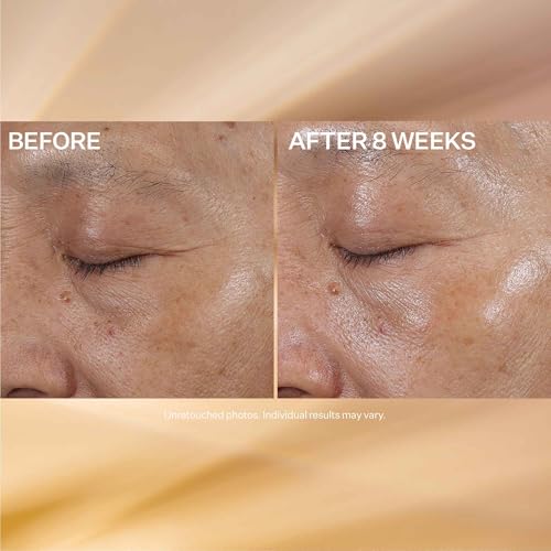 StriVectin Super-C Eye Vitamin C Eye Cream, Brightening and Firming, Boost Skin Dullness with Hyaluronic Acid