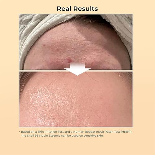 Snail Mucin Radiance Serum ? 96% Snail Filtrate Hydrating & Anti-Aging Face Serum for Fine Lines, Dark Spots & Smooth Skin ? 100ml