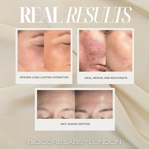 Advanced 3 IN 1 SNAIL MUCIN SUPER SERUM infused with FACELIFT Peptide by BIOCORE LABS¢â Plumping,Moisturizing,Healing Serum for face 100ml 3.38 FL. OZ.