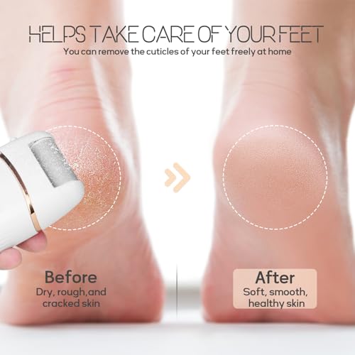 Electric Foot File and Callus Remover, Rechargeable Pedicure Device with Multiple Heads for Dry Rough Feet Care, Home Use Foot Grinder Tool