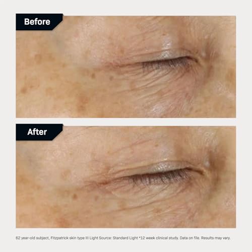 Revision Skincare D¡¤E¡¤J Eye Cream¢ç, Firming and Moisturizing Treatment for Fine Lines, Wrinkles and Crow¡¯s Feet
