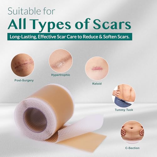 Silicone Scar Tape, Silicone Scar Sheets, Scar Tape for Surgical Scars, Silicone Tape for Scars, Scar Sheets for Surgical Scars, C-Section, Tummy Tuck and Keloid (1.6"x 60" Roll-1.5M)