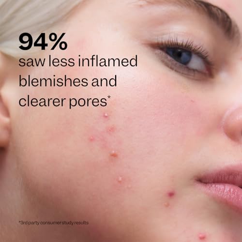 Peach Slices - Acne Clarifying Cleanser (4.05 oz) - 2% Salicylic Acid Acne Treatment - Clear & Prevent Breakouts, Hydrate - Cucumber, Cica, Acerola - Vegan, Cruelty Free, Korean Skin Care & Beauty