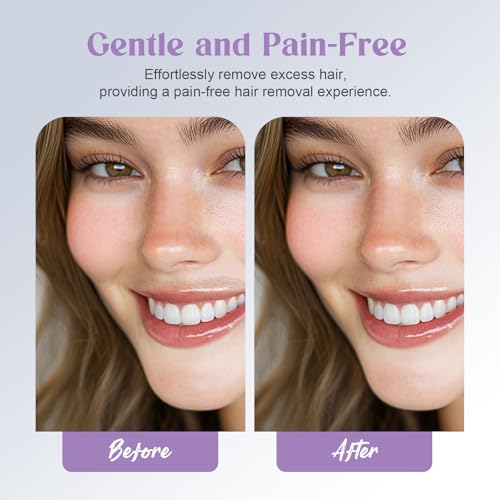 Battery Powered Facial Hair Remover for Women Lips, Chin, Neck, and Cheeks - Gentle and Pain with 2-pc Replacement Heads and 1 Battery
