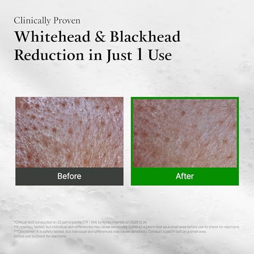 ECZEMA HONEY Soothing Facial Cream - Eczema Lotion for Face, Eyelids, Lips, and More - Natural Dry Skin Repair (2 Oz)