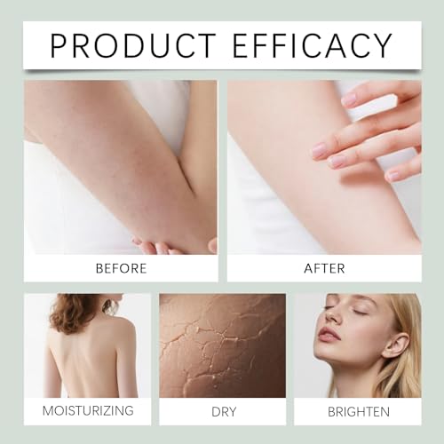 Intertrigo Cream ? Skin Fold Care & Chafing Support Cream ? Helps Soothe Irritated Skin, Fast-Drying Non-Greasy Formula for Friction-Prone Areas