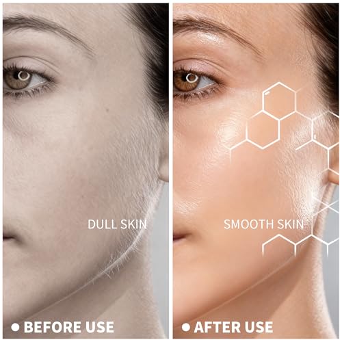 Sonic Dermaplaning Tool For Face - Painless Facial Hair Removal For Women,Anti-Nick Exfoliator For Sensitive Skin,Blades With A Protective Microblade System(Beginner Friendly)10refill Blades