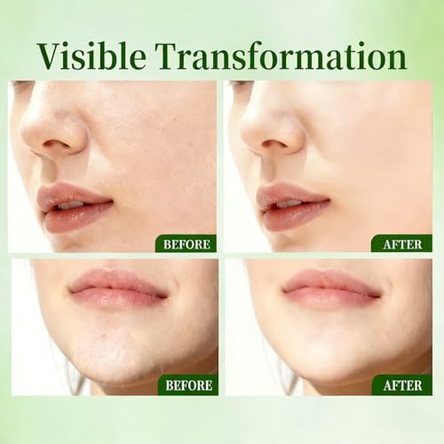 Facial Hair Removal Cream Kit - Painless 2-in-1 At-Home Hair Remover for Women, Includes Soothing Gel for Sensitive Skin, Gentle on Upper Lip, Chin & Facial Areas