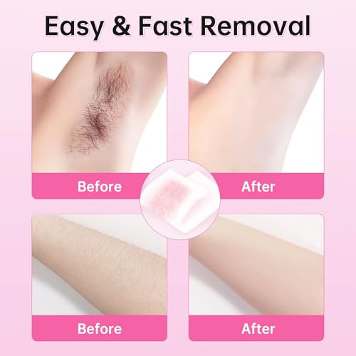 Beauty7 Roll On Wax, Body Hair Removal, Wax Roller Kit, 3 Packs Waxing Cartridge Depilatory Honey Refill, Underarm Leg Waxing for Women and Men, 5 Calming Oil Wipes, 50pcs Paper Strips