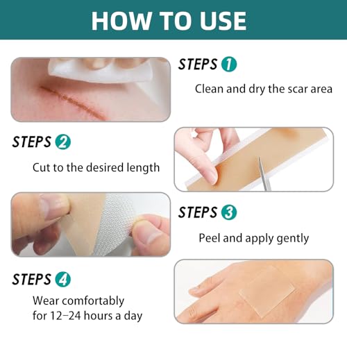 Silicone Scar Gel Sheets: Medical Grade Scar Tape for C Section Surgical Tummy Tuck Keloid Treatment?Scar Removal for Face and Skin