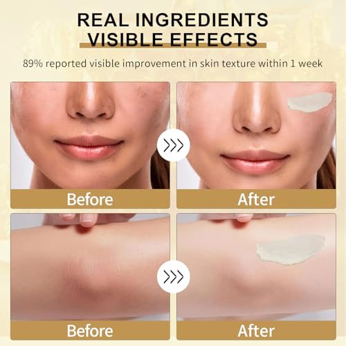 Beef Tallow for Skin, Beef Tallow Honey Balm-100% Organic Grass-Fed-handmade Whipped-Face & Body Moisturizer cream£¬with Manuka Wild Honey, Natural Skin Care for Sensitive, Dry Skin, Body Lotion. 2oz