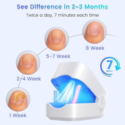 Home Toenail Repair Treatment for Toenail & Fingernail, 7 Minutes Timer, Rechargeable