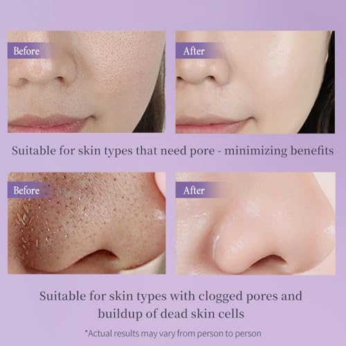 Face Exfoliator, Gentle Exfoliating Gel & Gommage for Face and Body, Removes Dead Skin Cells, Deep Cleansing & Hydrating for Dry & Sensitive Skin, Non-Abrasive Formula, 2.03 Fl Oz