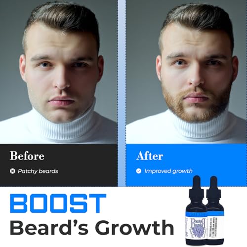 Organic Beard Oil - 1floz/30ml - SLOTH