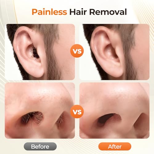 Nose Wax Kit Men, Nose Ear Hair Removal Kit for Men Women, 40 Sticks, 100g Wax, USB Fast Heat, Smart Constant Temp, Painless Hair Removal Waxing Kit for Nose Ears Eyebrow Lip Facial, Yellow