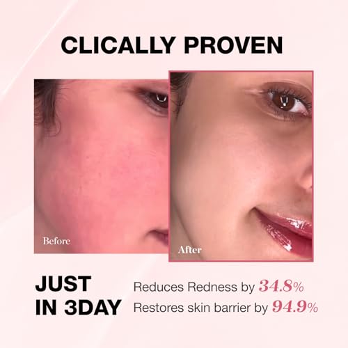 Physiogel Redness Reducing Cream ? Ceramide Moisturizer for Dry, Sensitive & Redness-Prone Skin, Repairs Skin Barrier, Dermatologist-Tested, Fragrance-Free, Korean Skincare, 1.69 fl oz