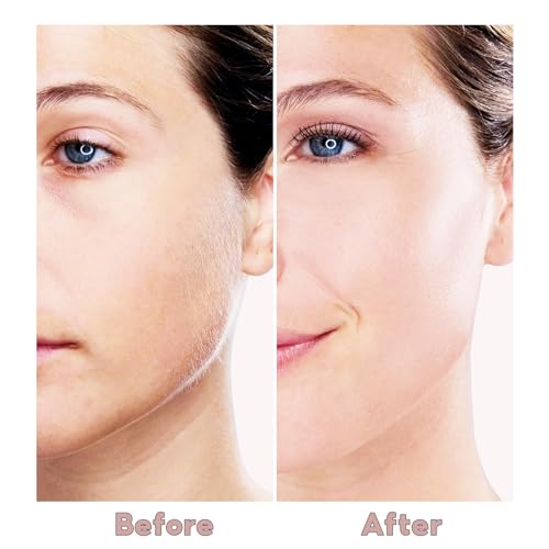 Facial Hair Removal for Women, Painless Face Trimmer for Upper Lips, Peach Fuzz and Chin with USB Rechargeable