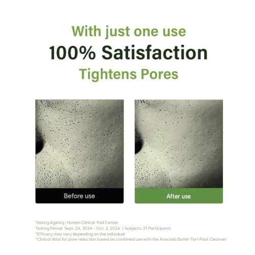 Cypress Aloe Calming Toner Pads [70 Sheets] ? Instantly Cooling & Soothing Toner with Centella Asiatica, Reduce Redness & Pore Care, Vegan, Dermatologist-Tested for Sensitive & Acne-Prone Skin