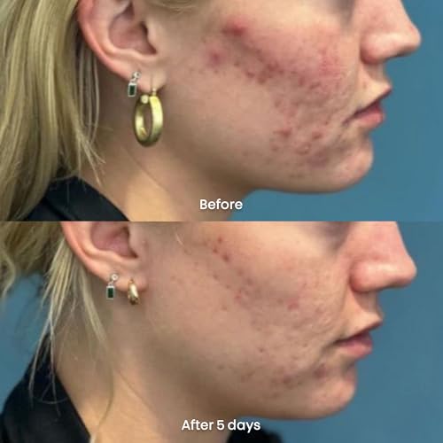 Bioxcin Collagen 5% Anti-Wrinkle Firming Serum 30 ML