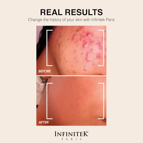 Infinitek Paris | Retinol Face Moisturizer - Night Cream | Skin Care for Galentine¡¯s Gifts & Valentine¡¯s Day Gifts for Women | Anti-Aging Face Cream with Collagen & Vitamin E | 1.7 oz - 50 g