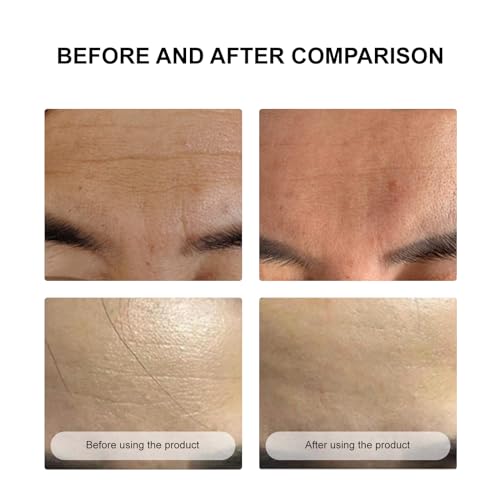 Forehead Wrinkle Patches Sheet Masks, Anti-Wrinkle Forehead Patches for Men & Women Facial Masks Skincare