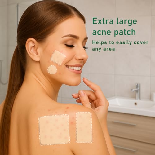 Original Hydrocolloid Acne Patches (17 Count) | Medical Grade for Cystic Breakouts, Invisible Spot Treatment & Overnight Healing