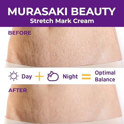 Stretch Mark Cream Prevention for Pregnancy - Maternity Cream for Stretch Marks Removal | Nourishing Formula ? Prevents Stretch Marks & Improves Elasticity - 4 oz (120g) (2 Pack)
