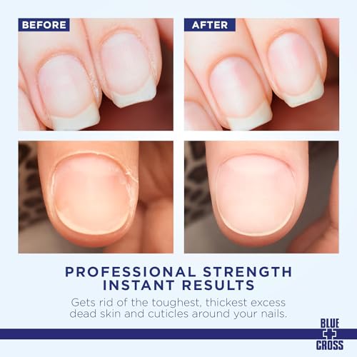 Blue Cross Ultimate Nail Care Bundle - 2oz Cuticle Remover + Softener Cream, 0.5oz Yello Out Yellow Neutralizing Basecoat + 0.5oz Nourishing Cuticle + Nail Oil, 3 Pack Bundle
