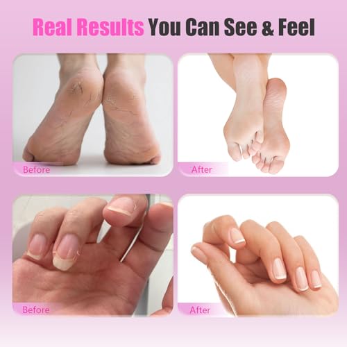 Electric Callus Remover for Feet ? 2-in-1 Rechargeable Foot Sander with Sandpaper Discs & Nail Drill Bits, Adjustable Speed, LED Display, Professional Pedicure Tool for Home & Travel