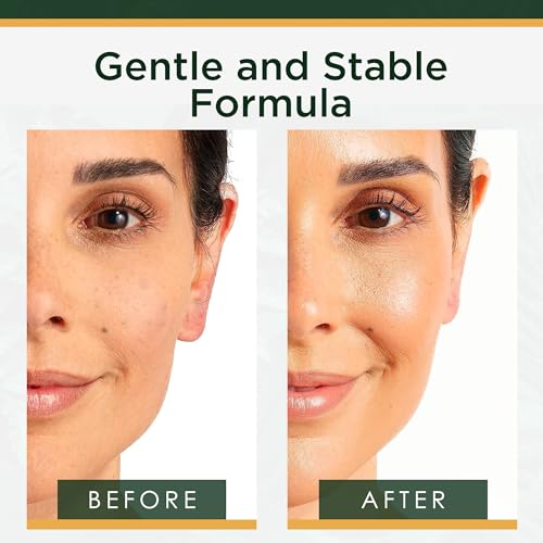 Hyaluronic Acid Serum for Skin ? Anti-Aging Moisturizer Face Serum for Brightening, Plumper & Smoother Skin. Non-Greasy, Ultra-Hydrating Niacinamide, B5 & Vitamin C Skin Care Facial Serum, 2 oz