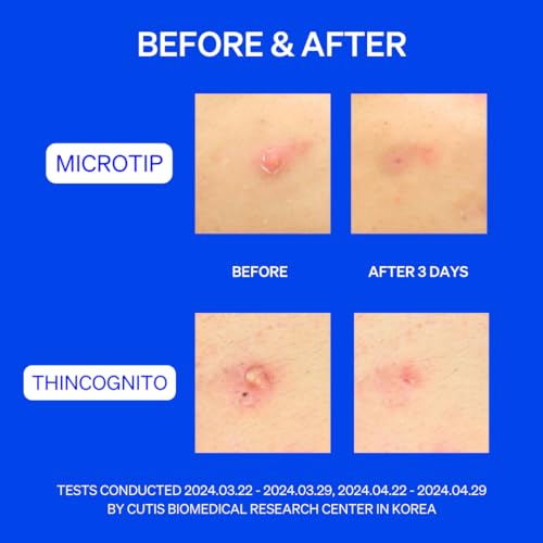 Right Away Duo, Microtip Hydrocolloid Acne Pimple Patch and Thincognito Invisible Spot Patch