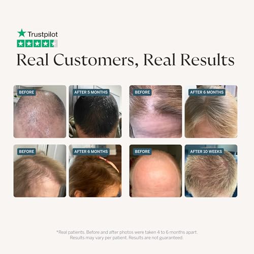Happy Head Dermaroller for Scalp, Beard and Face ? 0.25mm Microneedling Tool to Help Scalp Stimulation, Refine ? Skin Care and Grooming for Men and Women
