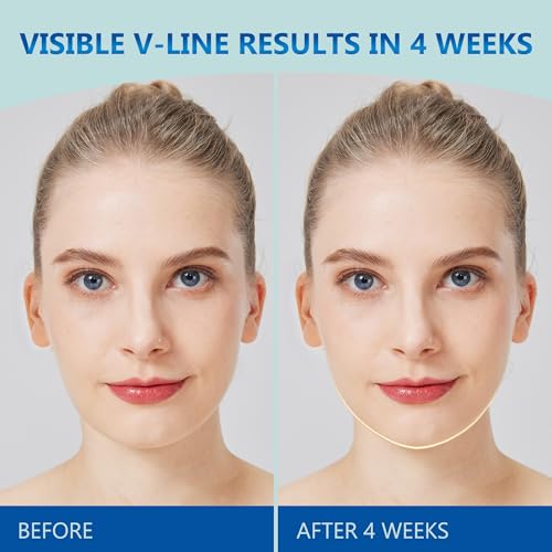 V Line Lifting Mask for Women, Double Chin Strap w/Hyaluronic Acid Serum & 3D Face Roller for Tightening and Firming | Comfortable, Adjustable, and Pressure-Free (Pink, M-L)