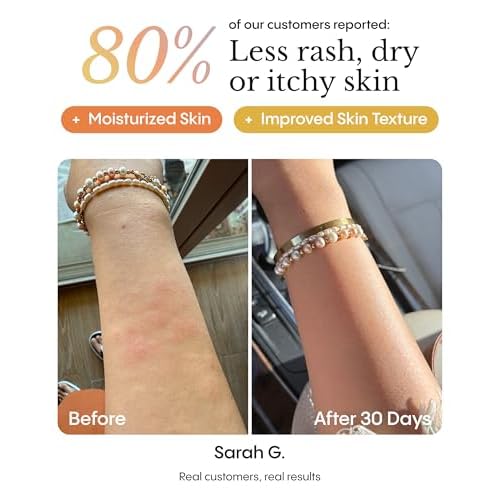 FR¨ªYA Organics | Calming Relief Balm for Red Itchy Flaky Skin | Blue Chamomile & Thistle for Chronic Dryness | Soothes Irritation Redness & Discomfort | Face & Body Moisturizer | Natural | 100ml